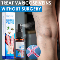Varicose Vein Spray Multi-Purpose Knee And Leg Care Spray Promote Blood Circulation