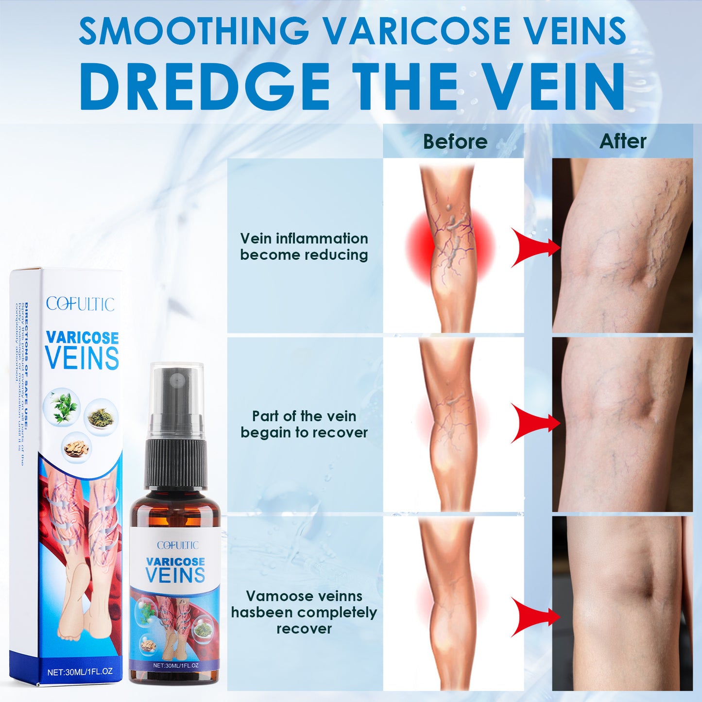 Varicose Vein Spray Multi-Purpose Knee And Leg Care Spray Promote Blood Circulation