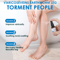 Varicose Vein Spray Multi-Purpose Knee And Leg Care Spray Promote Blood Circulation