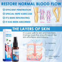 Varicose Vein Spray Multi-Purpose Knee And Leg Care Spray Promote Blood Circulation